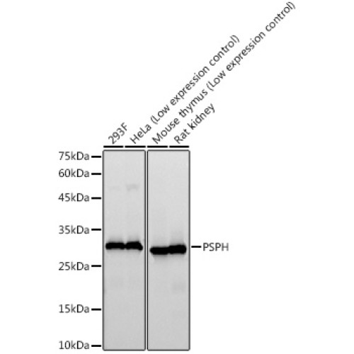 PSPH Rabbit mAb