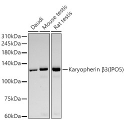Karyopherin β3 (IPO5) Rabbit mAb