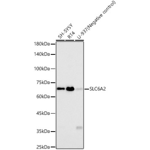 SLC6A2 Rabbit mAb