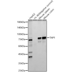 TAP1 Rabbit mAb