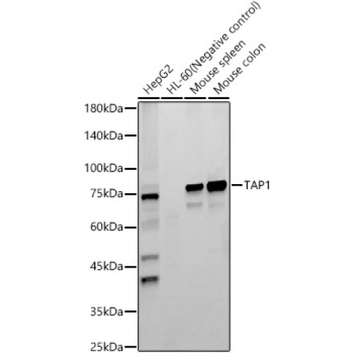 TAP1 Rabbit mAb