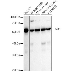 [KO Validated] AKT1 Rabbit mAb