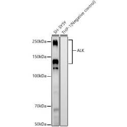 ALK Rabbit mAb