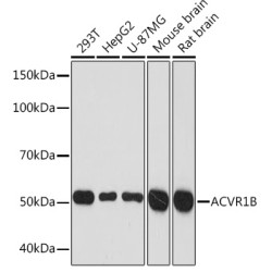 ACVR1B Rabbit mAb
