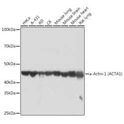α-Actin-1 (ACTA1) Rabbit mAb