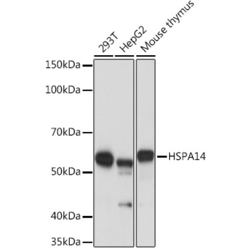 HSPA14 Rabbit mAb