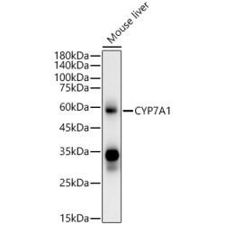 CYP7A1 Mouse mAb