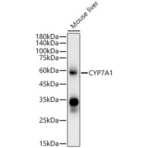 CYP7A1 Mouse mAb