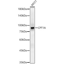 [KO Validated] CPT1A Rabbit mAb