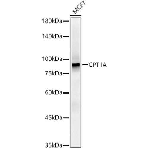 [KO Validated] CPT1A Rabbit mAb
