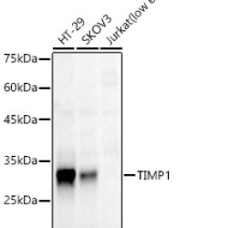 TIMP1 Rabbit mAb