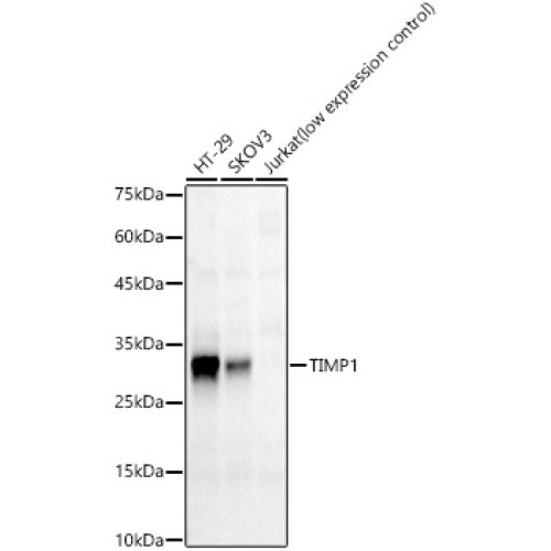 TIMP1 Rabbit mAb