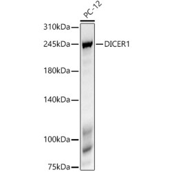 DICER1 Rabbit mAb