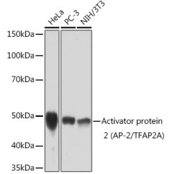 Activator protein 2 (AP-2/TFAP2A) Rabbit mAb