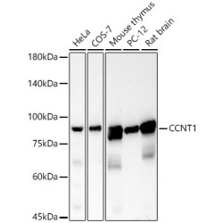 CCNT1 Rabbit mAb