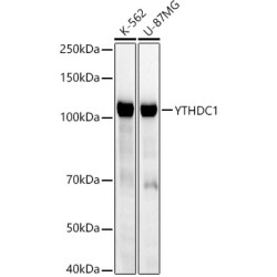 [KD Validated] YTHDC1 Rabbit mAb