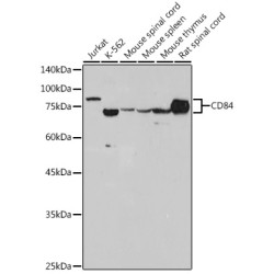 CD84 Rabbit mAb