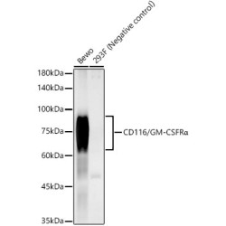 CD116/GM-CSFRα Rabbit mAb
