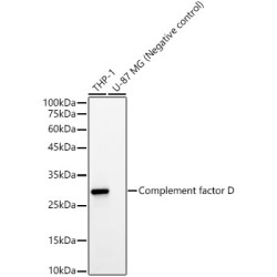 Complement factor D Rabbit mAb