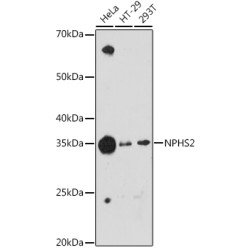 NPHS2 Rabbit mAb