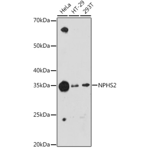 NPHS2 Rabbit mAb