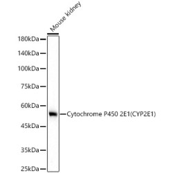 Cytochrome P450 2E1 (CYP2E1) Rabbit mAb