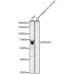 BTN2A1 Rabbit mAb