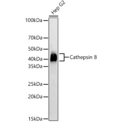 Cathepsin B Rabbit mAb