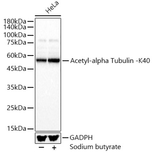 Acetyl-alpha Tubulin -K40 Rabbit pAb