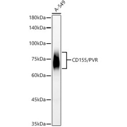 CD155/PVR Rabbit mAb
