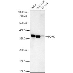 PDXK Rabbit mAb