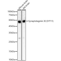 Synaptotagmin XI (SYT11) Rabbit mAb