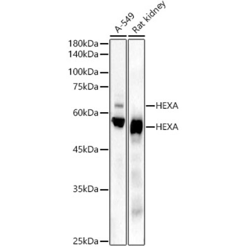 HEXA Rabbit mAb