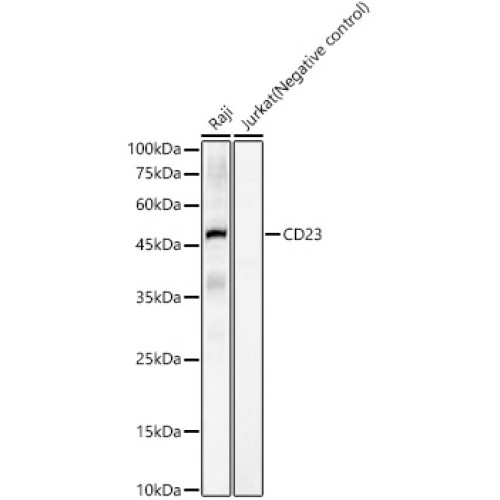 CD23 Rabbit mAb