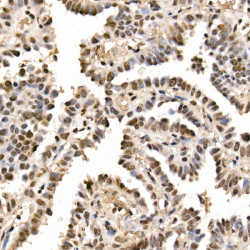 GLI2 Rabbit mAb