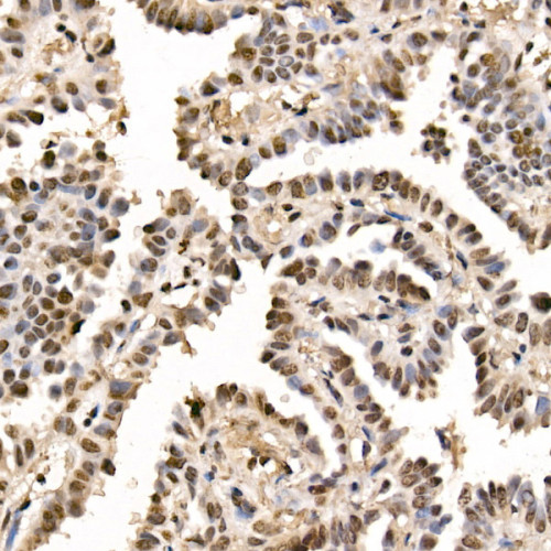 GLI2 Rabbit mAb