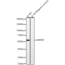 AMHR2 Rabbit mAb