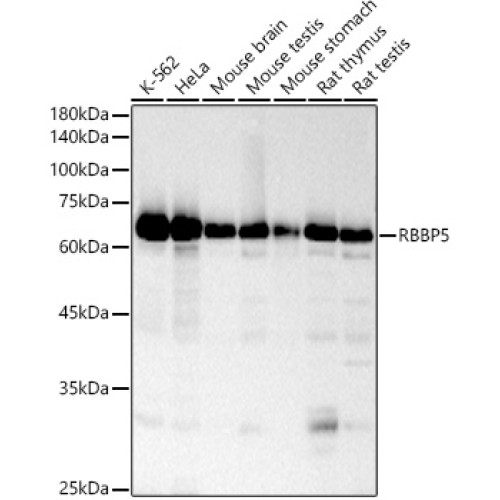 RBBP5 Rabbit mAb