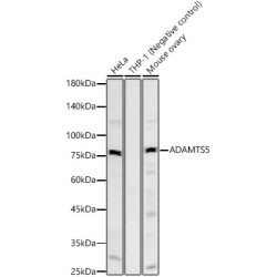 ADAMTS5 Rabbit mAb