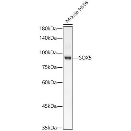 SOX5 Rabbit mAb