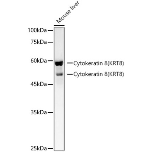 Cytokeratin 8 Rabbit mAb