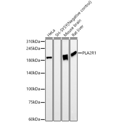 PLA2R1 Rabbit mAb