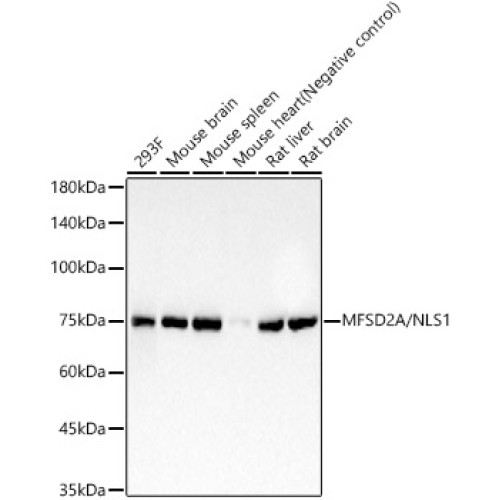 MFSD2A/NLS1 Rabbit mAb
