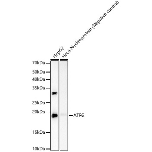 ATP6 Rabbit mAb