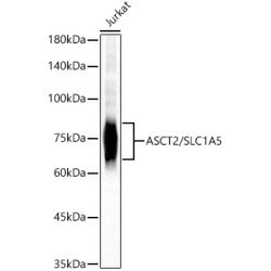 ASCT2/SLC1A5 Rabbit mAb