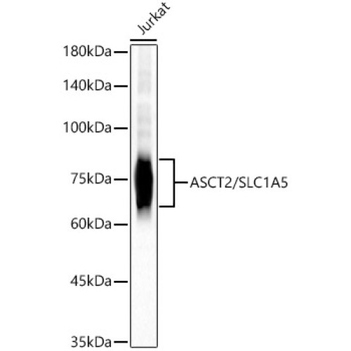 ASCT2/SLC1A5 Rabbit mAb