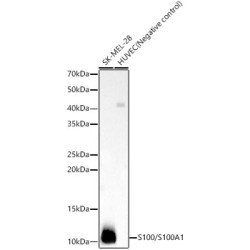 S100/S100A1 Rabbit mAb