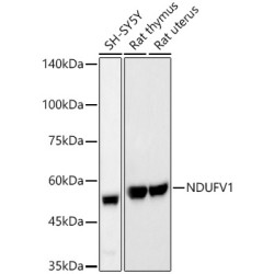 NDUFV1 Rabbit mAb