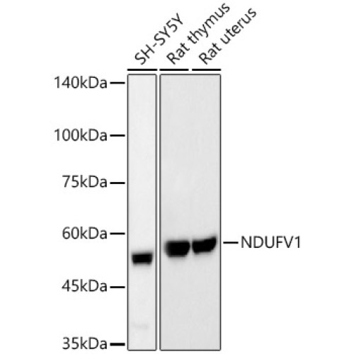 NDUFV1 Rabbit mAb