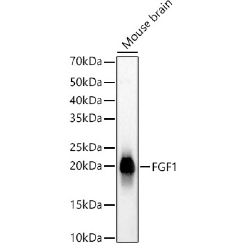 FGF1 Rabbit mAb